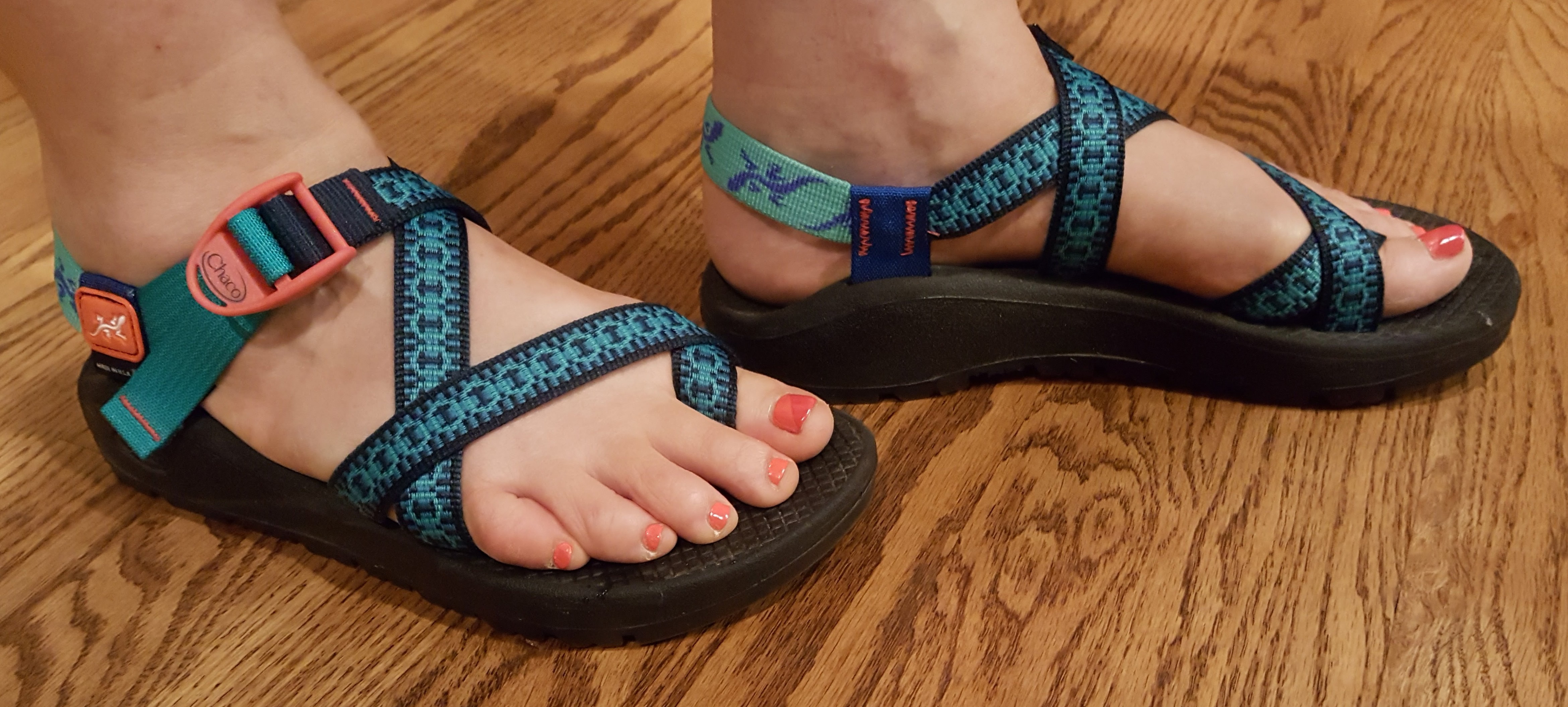 chacos and plantar fasciitis